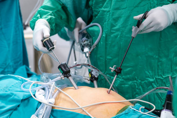 Endoscopy & Laparoscopy