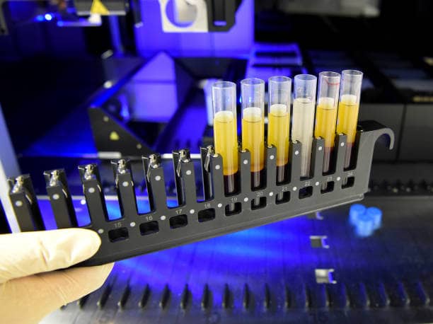 Veterinary Biochemistry Analyser